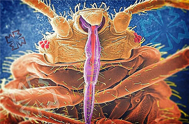Како изгледају угризи буба: њихове посљедице и лијечење
