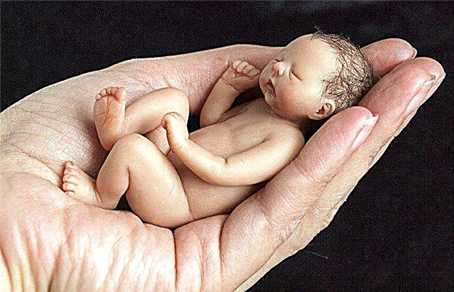 Top 10 kleinste pasgeboren baby's ter wereld