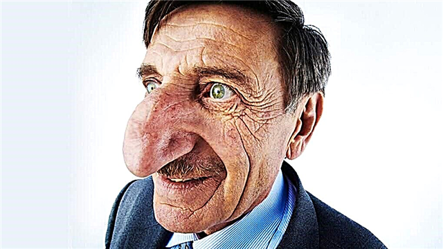 10 pessoas com o nariz mais comprido do mundo