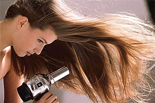 10 real causes of dandruff