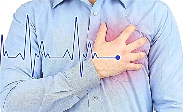 10 objawów, które warto udać się do kardiologa