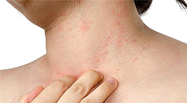 10 signos de mala salud que tu piel te dice