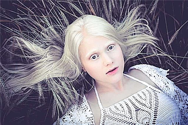10 fatos interessantes sobre albinos