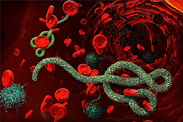 Os 10 vírus mais perigosos do mundo para humanos