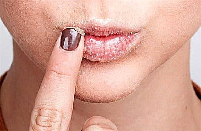 10 rules for lip care in winter