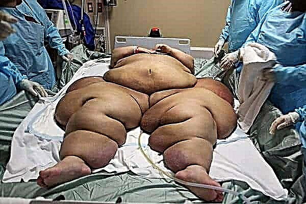 दुनिया के शीर्ष 10 सबसे मोटे लोग